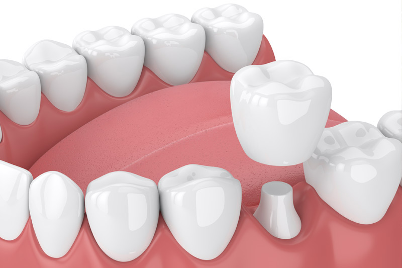 Dr. Saad Dental Care Special Offer