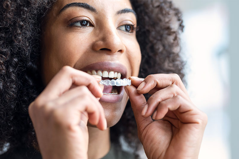 Invisalign in Van Nuys