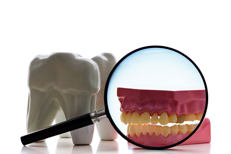 Root Canal Treatment in Van Nuys