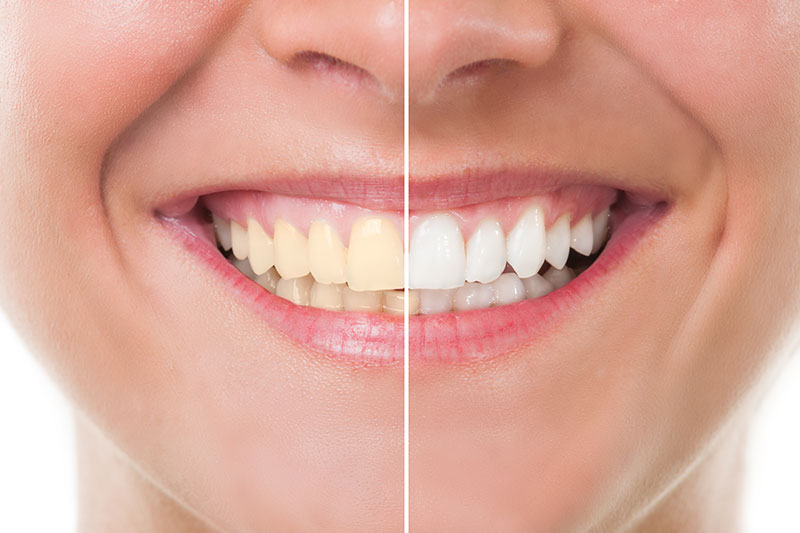 Dr. Saad Dental Care Special Offer