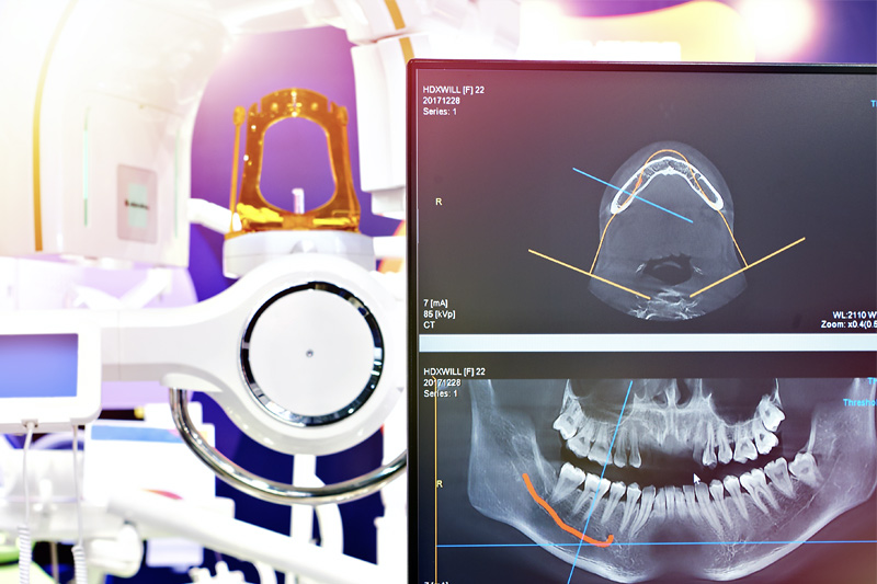 Digital X-Rays in Van Nuys